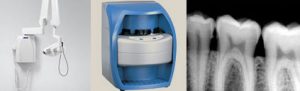 Digital X-rays