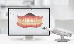 3Shape-Trios-300x180